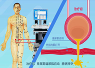 人和醫(yī)院 尿潴留、尿失禁動畫